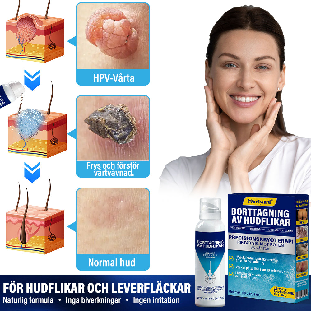 ✅ Officiell Flaggskeppsbutik | Ourlyard® TagRecede Kryobehandling Spray | Tar bort vårtor och hudflikar, lämplig för alla hudtyper.